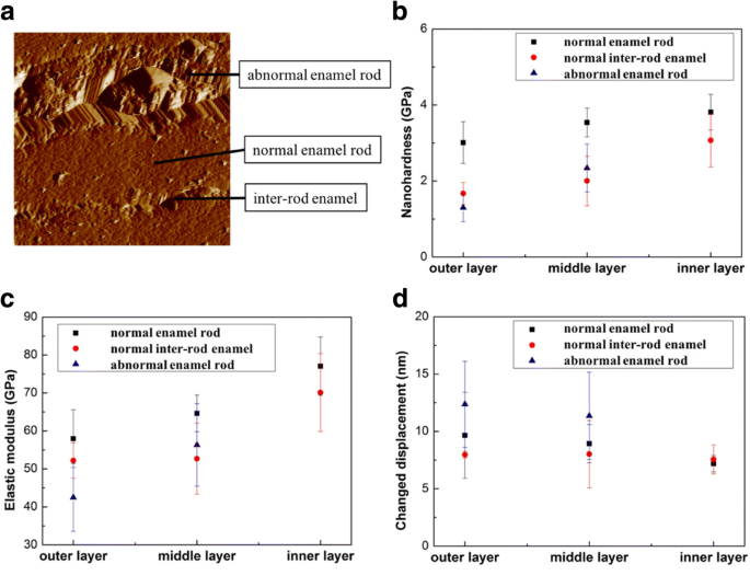 Gradient Nanomechanical Properties of Fluorosed Enamel: Implications for Restorative Material Selection