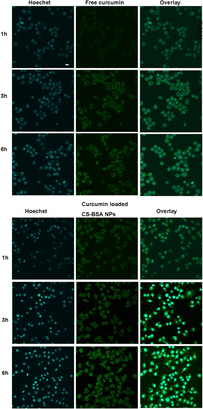 Curcumin‑Loaded Chitosan–Bovine Serum Albumin Nanoparticles Enhance Amyloid‑β42 Clearance and Modulate Macrophage Polarization in Alzheimer’s Disease