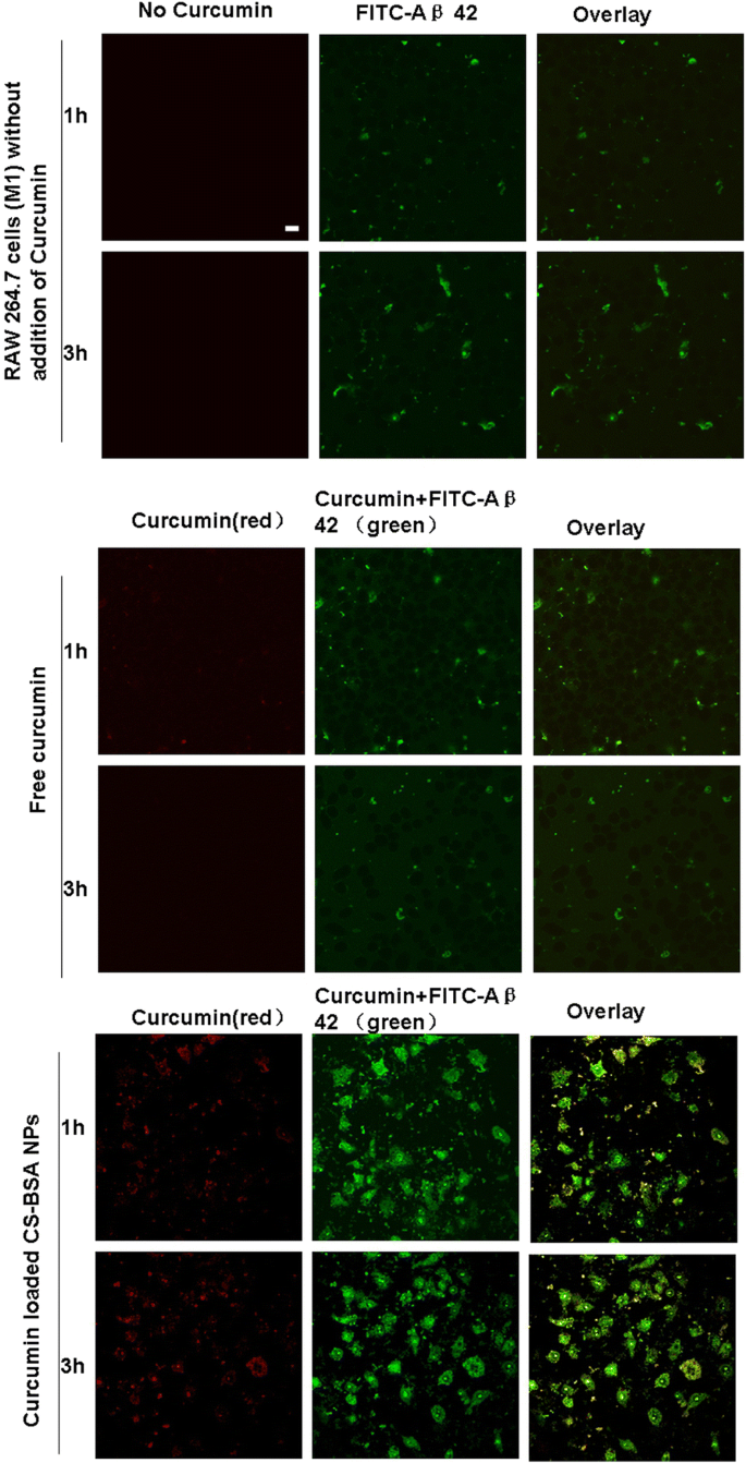 Curcumin‑Loaded Chitosan–Bovine Serum Albumin Nanoparticles Enhance Amyloid‑β42 Clearance and Modulate Macrophage Polarization in Alzheimer’s Disease