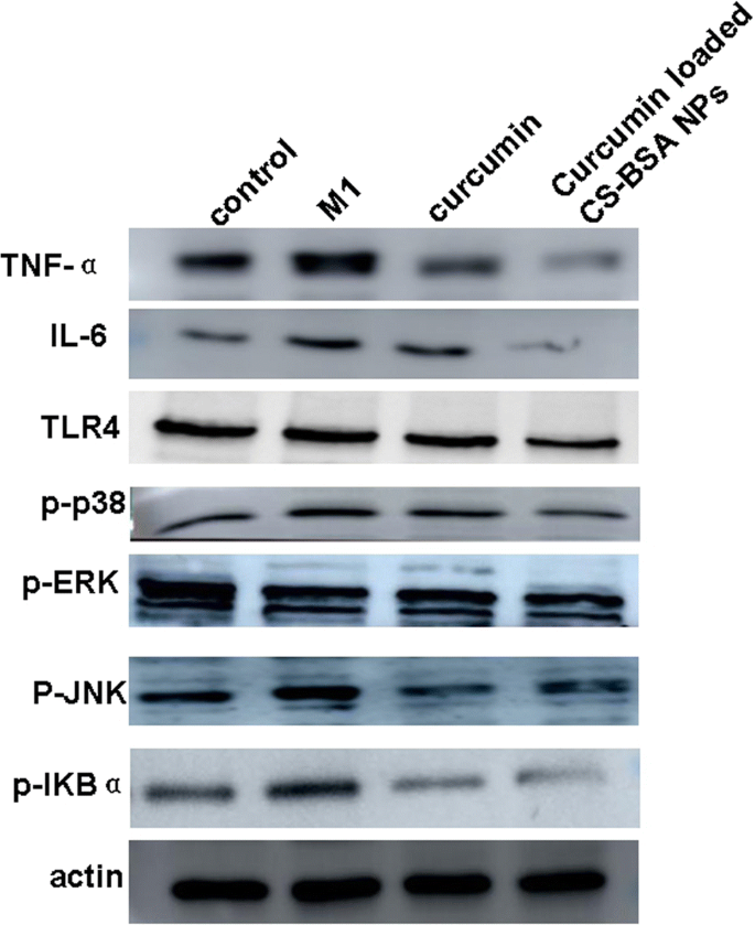 Curcumin‑Loaded Chitosan–Bovine Serum Albumin Nanoparticles Enhance Amyloid‑β42 Clearance and Modulate Macrophage Polarization in Alzheimer’s Disease