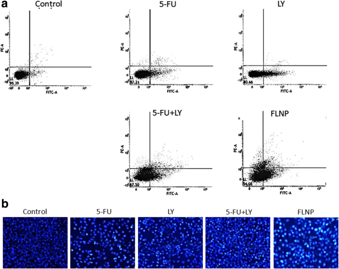 Targeted Co‑Delivery of 5‑Fluorouracil and LY294002 via PEG‑Lipid Nanoparticles Enhances Antitumor Efficacy in Esophageal Squamous Cell Carcinoma