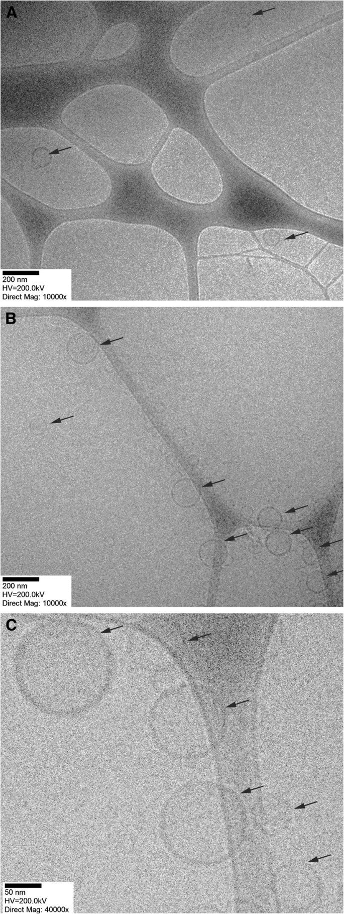 Targeted Cancer Delivery: Decorating Nanovesicles with pHLIP for Acidic Tumor Microenvironment Recognition