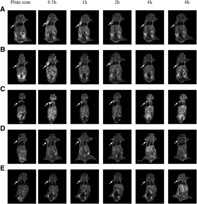 Dual-Targeted Paramagnetic Liposomes for αvβ3 Integrin and NRP‑1: A Powerful MRI Tool for Early Tumor Detection