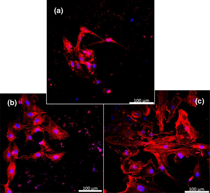 Laser‑Assisted MAPLE Deposition of Antibody‑Functionalized Upconversion Nanoparticles Enhances Cell Culture Performance