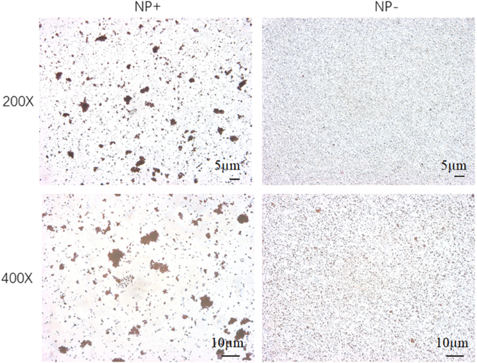 Rapid Capture of Escherichia coli at Ultralow Concentrations Using Positively Charged Magnetic Nanoparticles