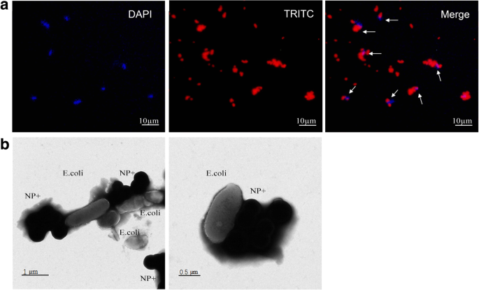 Rapid Capture of Escherichia coli at Ultralow Concentrations Using Positively Charged Magnetic Nanoparticles