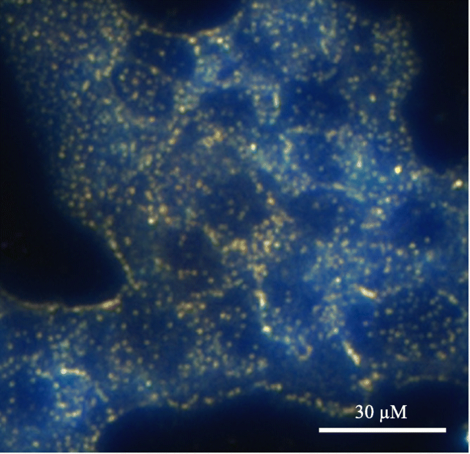 Magnetic Core‑Shell Nanoparticles: Advancing Targeted Drug Delivery, Imaging, and Antimicrobial Therapies