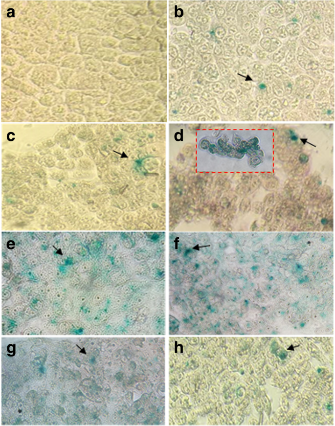 Enhanced Gene Delivery Using Gold Nanoparticles Functionalized with Chitosan, N‑Acylated Chitosan, and Chitosan Oligosaccharide