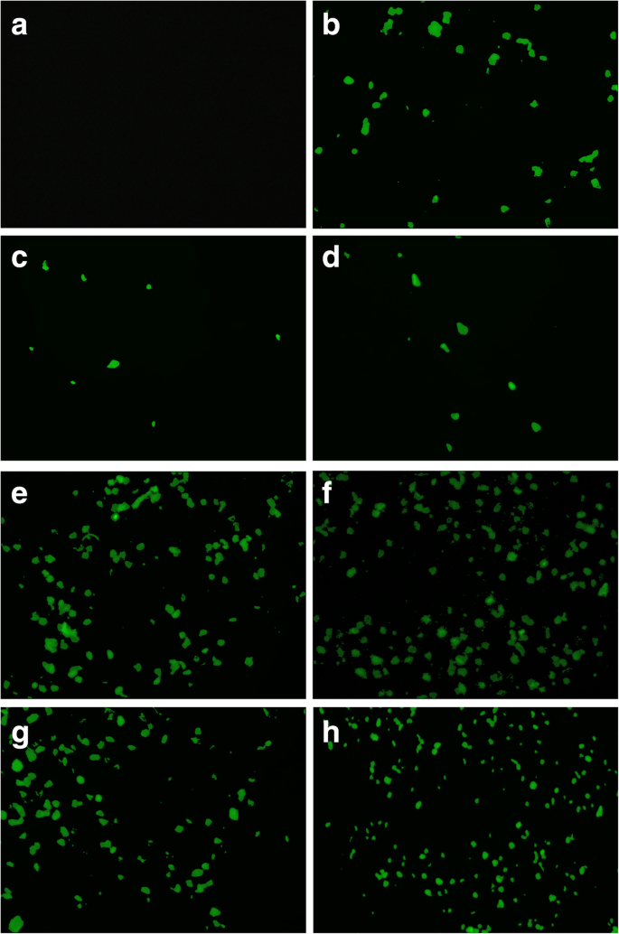 Enhanced Gene Delivery Using Gold Nanoparticles Functionalized with Chitosan, N‑Acylated Chitosan, and Chitosan Oligosaccharide