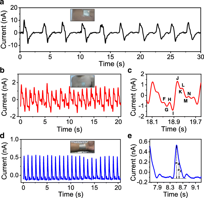 Revolutionizing Self-Powered Wearables: Electrospun PTFE Nanofiber Membranes Deliver Unmatched Sensor Performance