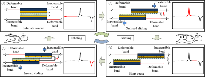 Wearable Wireless Triboelectric Nanogenerator for Real‑Time Respiratory Monitoring