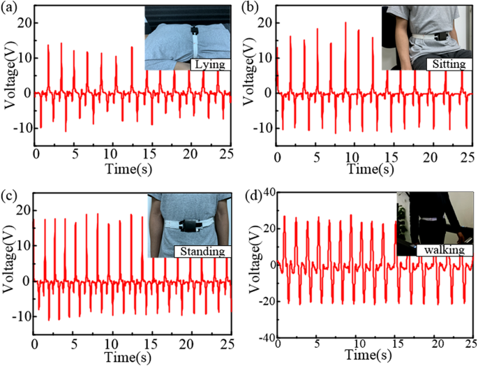 Wearable Wireless Triboelectric Nanogenerator for Real‑Time Respiratory Monitoring