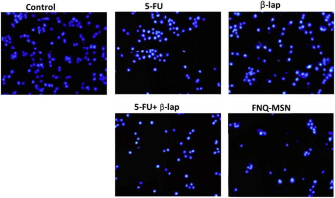 Mesoporous Silica Nanoparticles Co-Deliver NQO1 Inhibitor and 5‑Fluorouracil, Enhancing Antitumor Activity in Head and Neck Squamous Cell Carcinoma