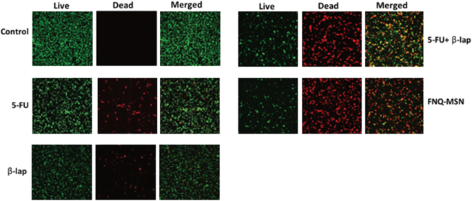 Mesoporous Silica Nanoparticles Co-Deliver NQO1 Inhibitor and 5‑Fluorouracil, Enhancing Antitumor Activity in Head and Neck Squamous Cell Carcinoma