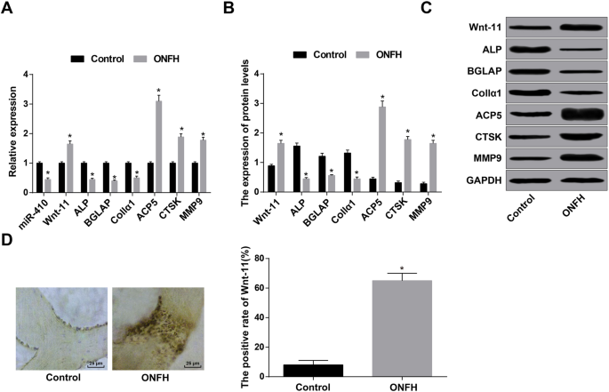 Targeting miR‑410/Wnt‑11 Regulates Bone Formation and Inhibits Osteoclasts to Treat Femoral Head Osteonecrosis