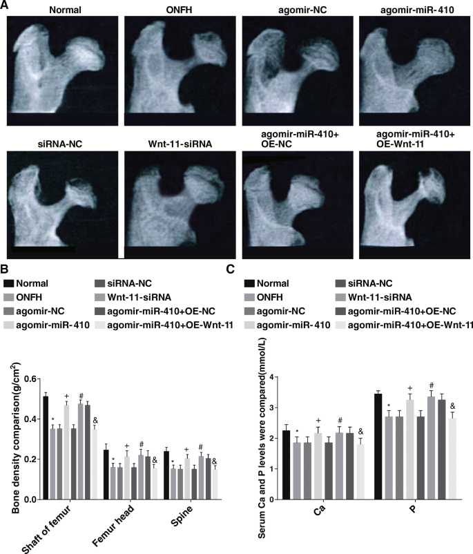Targeting miR‑410/Wnt‑11 Regulates Bone Formation and Inhibits Osteoclasts to Treat Femoral Head Osteonecrosis