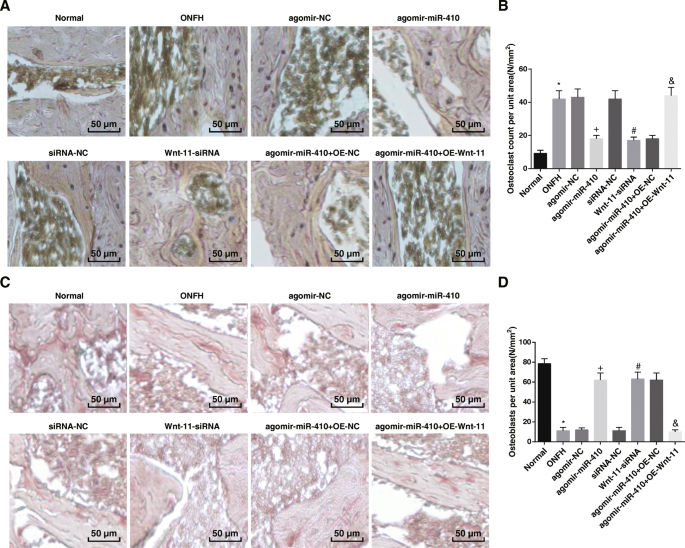 Targeting miR‑410/Wnt‑11 Regulates Bone Formation and Inhibits Osteoclasts to Treat Femoral Head Osteonecrosis