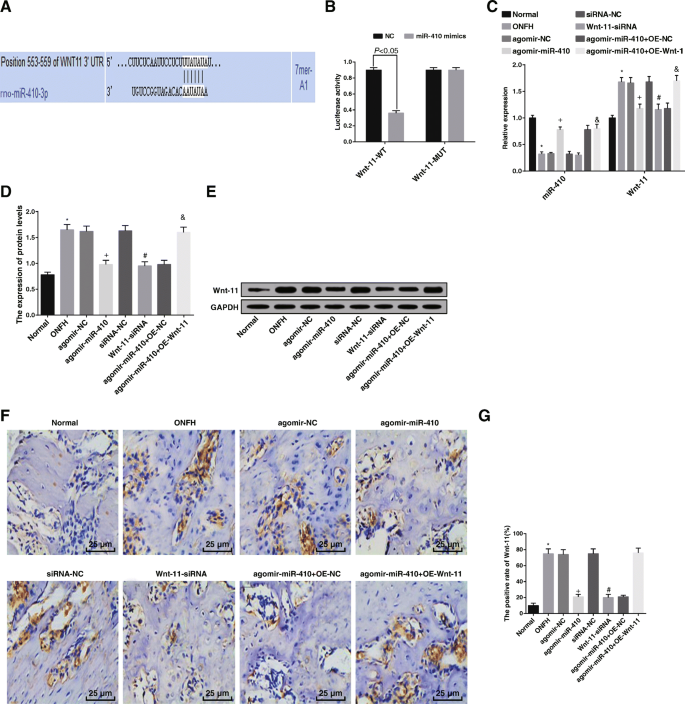 Targeting miR‑410/Wnt‑11 Regulates Bone Formation and Inhibits Osteoclasts to Treat Femoral Head Osteonecrosis