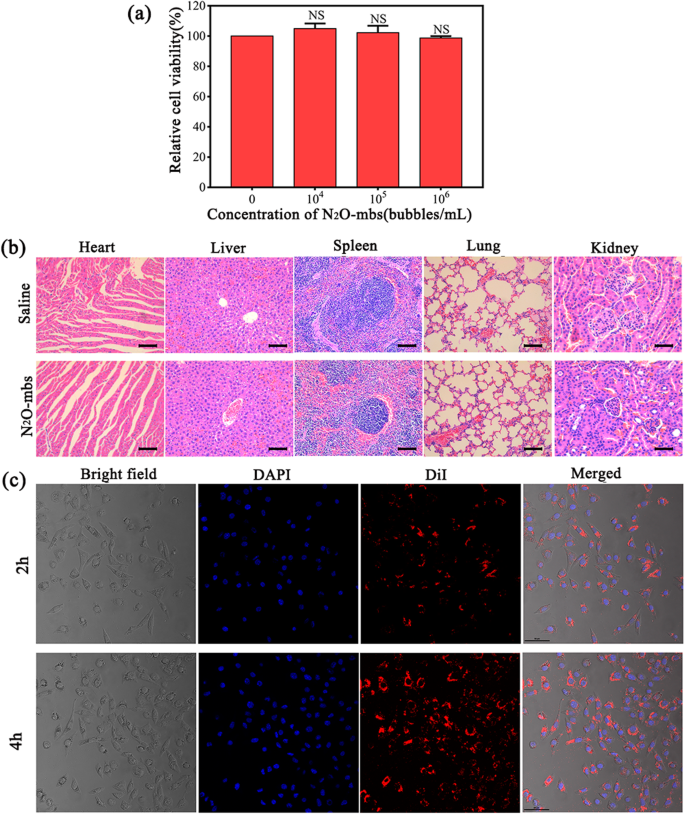 Improving HIFU Cancer Therapy Using Sonodynamic N2O Microbubbles