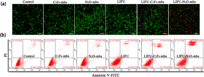 Improving HIFU Cancer Therapy Using Sonodynamic N2O Microbubbles