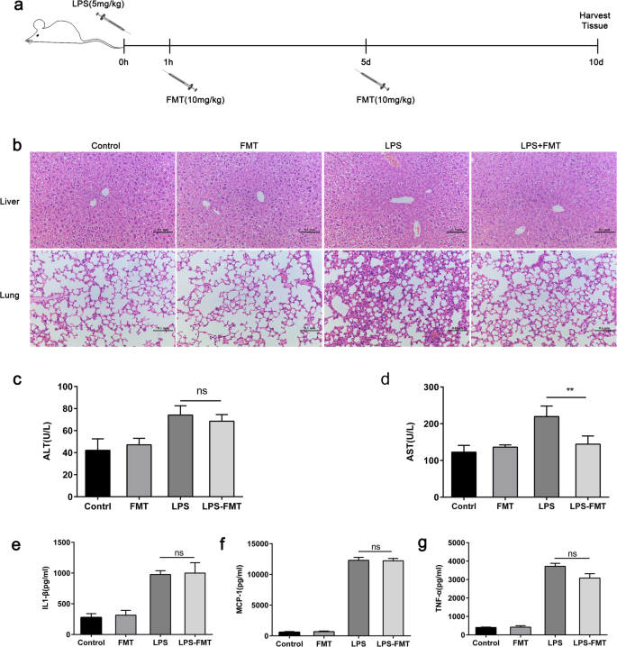 Ferumoxytol Reduces MDSC Activity to Alleviate LPS‑Induced Immunosuppression in Sepsis