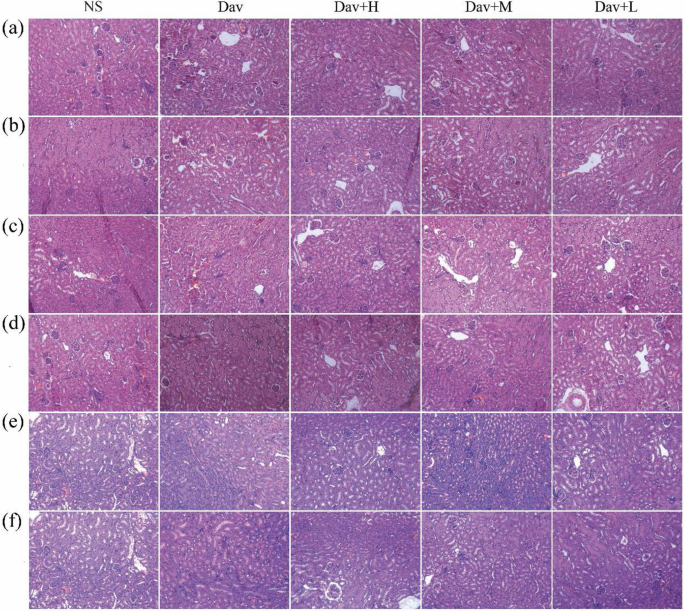 Carbon Dots Derived from Phellodendri Chinensis Cortex Carbonisata Safeguard Kidneys from Deinagkistrodon acutus Venom-Induced Acute Kidney Injury