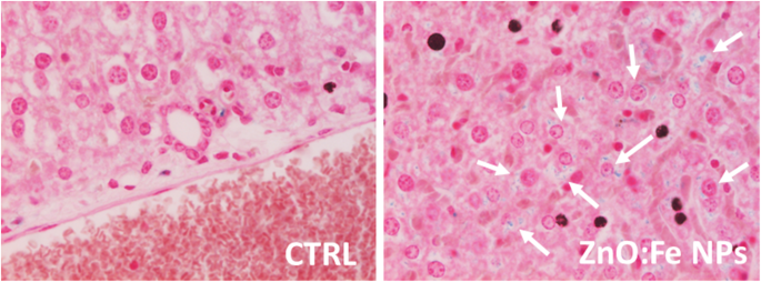 Biodegradable Fe‑Doped Zinc Oxide Nanoparticles: A Promising Iron Delivery System for Biological Applications