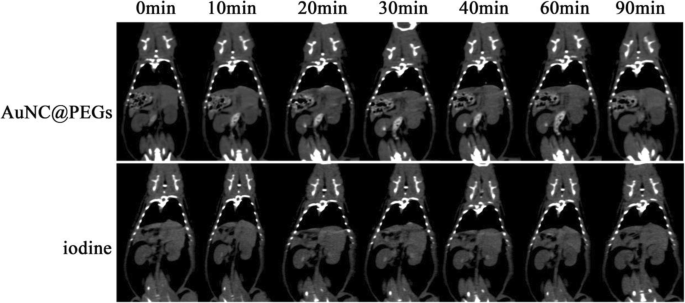 Highly Biocompatible Au Nanocage@PEG Nanoparticles: A Novel CT Contrast Agent for Enhanced In Vivo Imaging