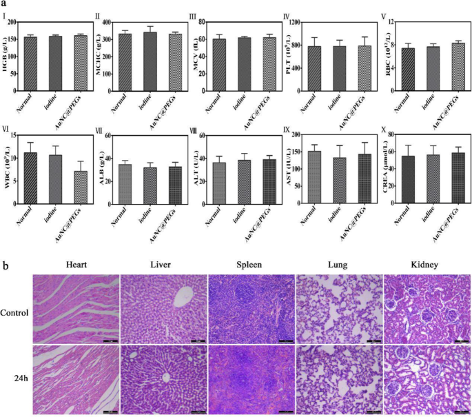 Highly Biocompatible Au Nanocage@PEG Nanoparticles: A Novel CT Contrast Agent for Enhanced In Vivo Imaging