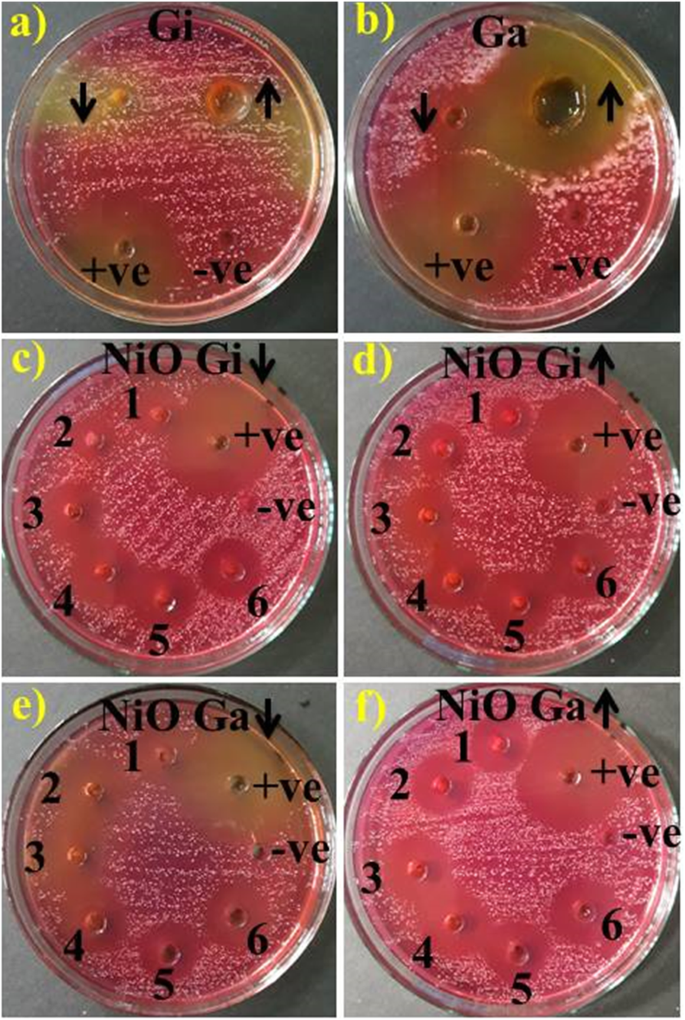 Green‑Synthesized Nickel Oxide Nanoparticles from Ginger and Garlic Show Strong Antibacterial & Catalytic Performance