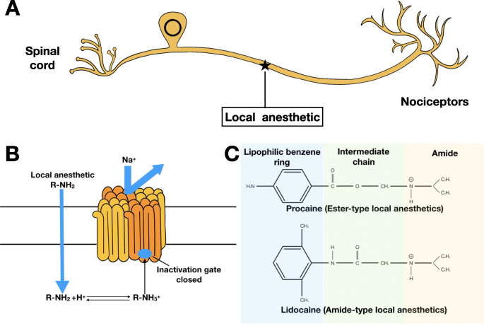 Nanostructured Extended-Release Local Anesthetics: Innovations and Clinical Impact