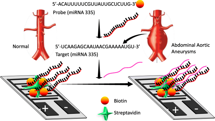Advanced Detection of miRNA‑335‑5p Using Interdigitated Electrodes to Assess Abdominal Aortic Aneurysm Severity