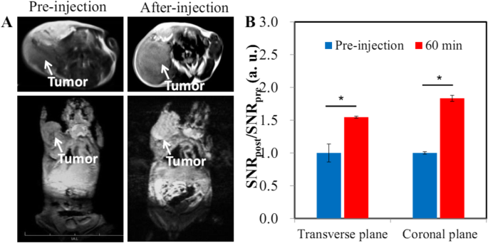 Hyaluronic Acid-Functionalized Gd₂O₃ Nanoparticles: Enhancing MRI-Guided Radiotherapy for Tumors