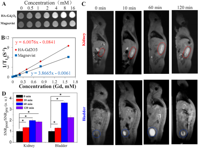 Hyaluronic Acid-Functionalized Gd₂O₃ Nanoparticles: Enhancing MRI-Guided Radiotherapy for Tumors