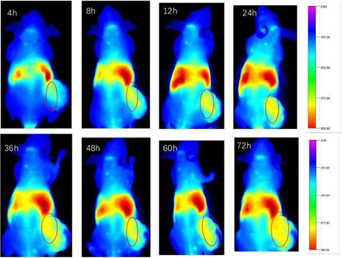 Emodin‑Loaded Stearic Acid‑G‑Chitosan Oligosaccharide Nanomicelles: Design, Characterization, and Antitumor Activity