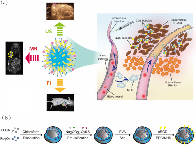 Biodegradable, Tumor‑Responsive Nanoparticles for Dual‑Modality Breast Cancer Imaging