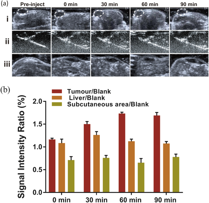 Biodegradable, Tumor‑Responsive Nanoparticles for Dual‑Modality Breast Cancer Imaging