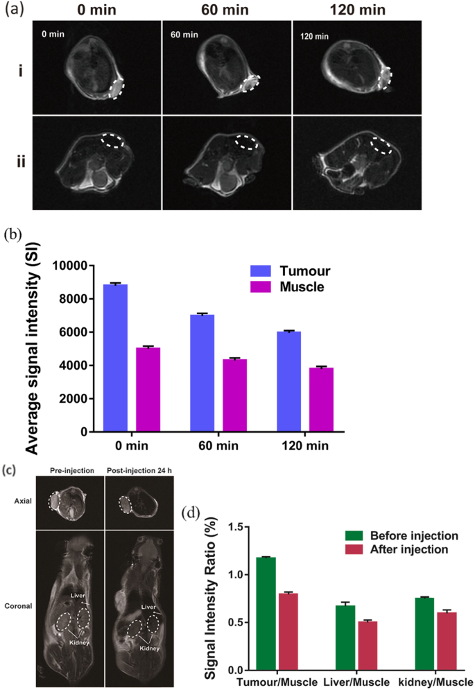 Biodegradable, Tumor‑Responsive Nanoparticles for Dual‑Modality Breast Cancer Imaging