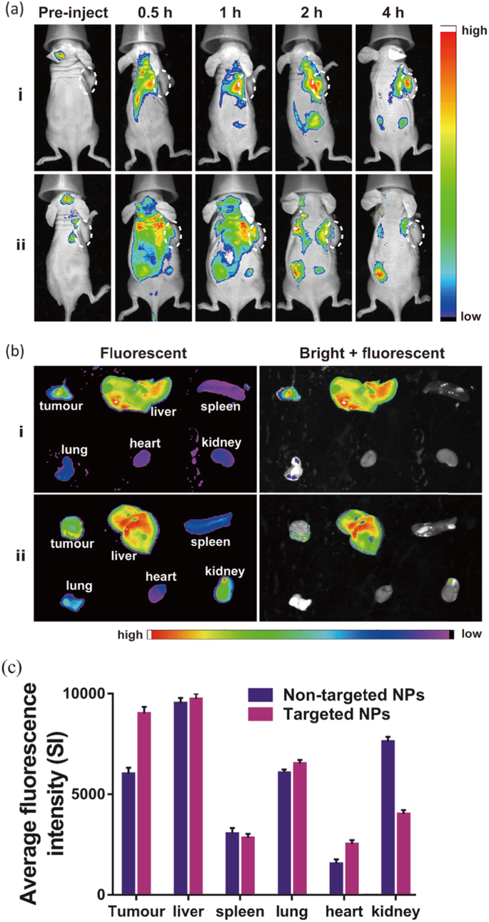 Biodegradable, Tumor‑Responsive Nanoparticles for Dual‑Modality Breast Cancer Imaging