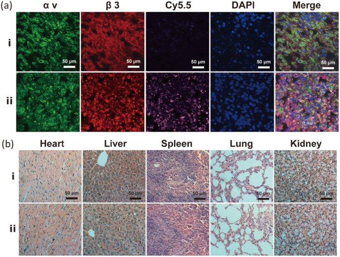 Biodegradable, Tumor‑Responsive Nanoparticles for Dual‑Modality Breast Cancer Imaging