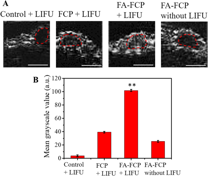 Targeted Curcumin Nanoparticles Activated by Low‑Intensity Focused Ultrasound for pH‑Responsive Theranostics in Ovarian Cancer