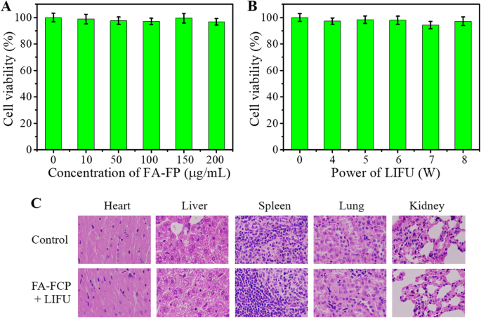 Targeted Curcumin Nanoparticles Activated by Low‑Intensity Focused Ultrasound for pH‑Responsive Theranostics in Ovarian Cancer