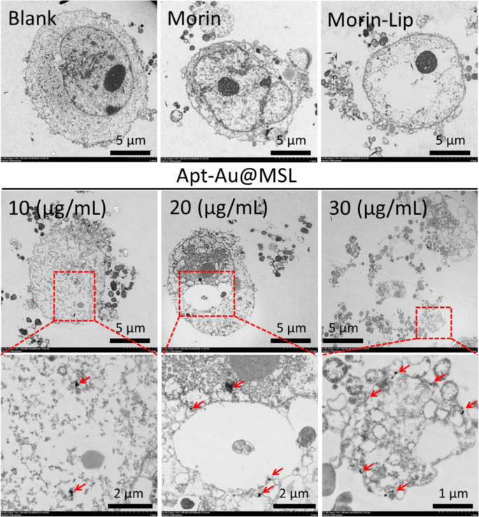 Targeted pH‑Responsive Liposomal Delivery of Morin via Aptamer‑Gold Nanoparticle Conjugates for Cancer Therapy