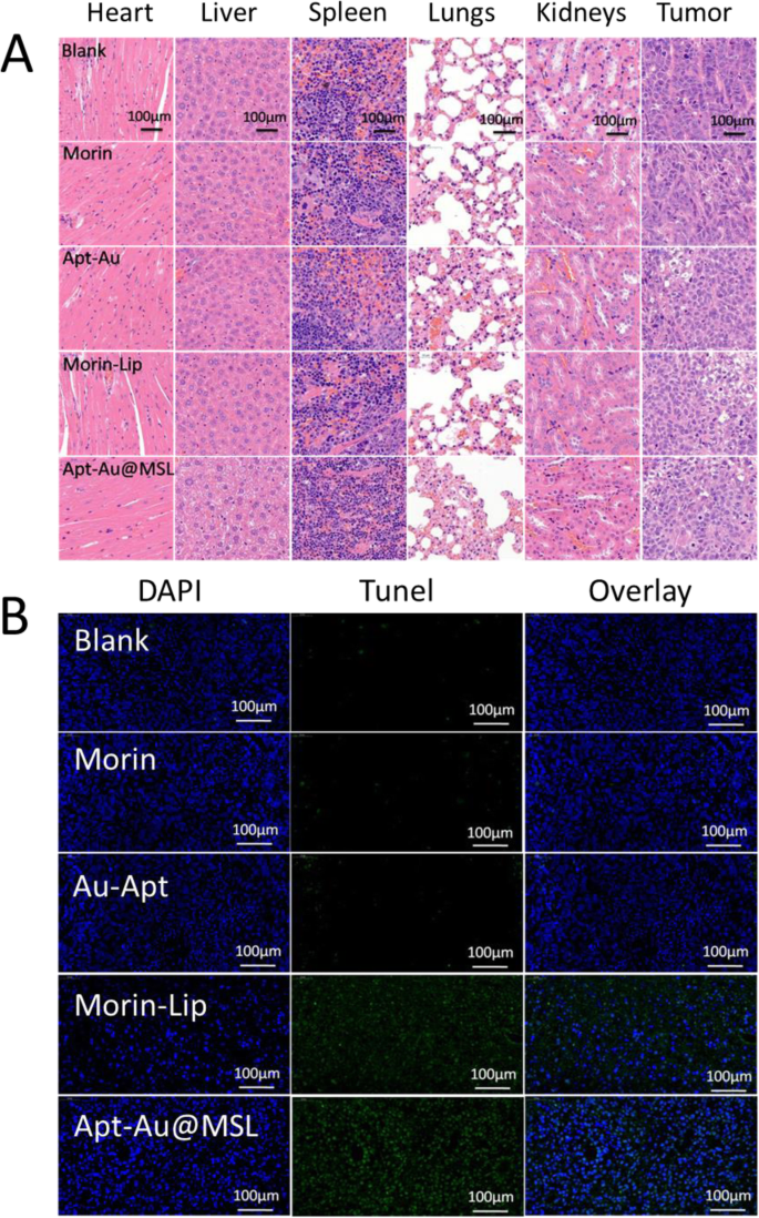 Targeted pH‑Responsive Liposomal Delivery of Morin via Aptamer‑Gold Nanoparticle Conjugates for Cancer Therapy