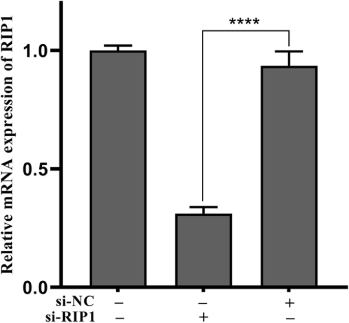 Nec-1 Mitigates Titanium Dioxide Nanoparticle-Induced Neurotoxicity in SH-SY5Y Cells via RIP1 Modulation
