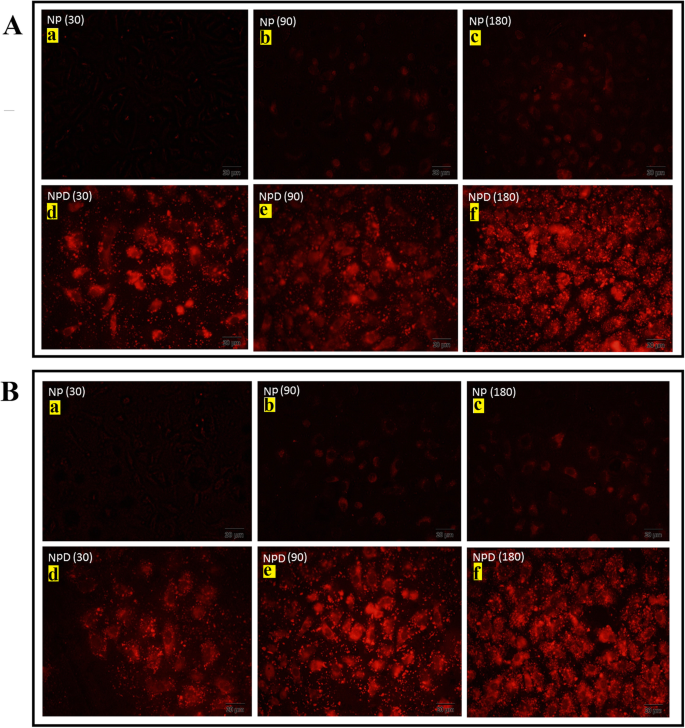 Innovative Methotrexate‑Folate Nanoparticle Therapy Enhances Breast Cancer Treatment with Laser‑Assisted Photothermal Approach