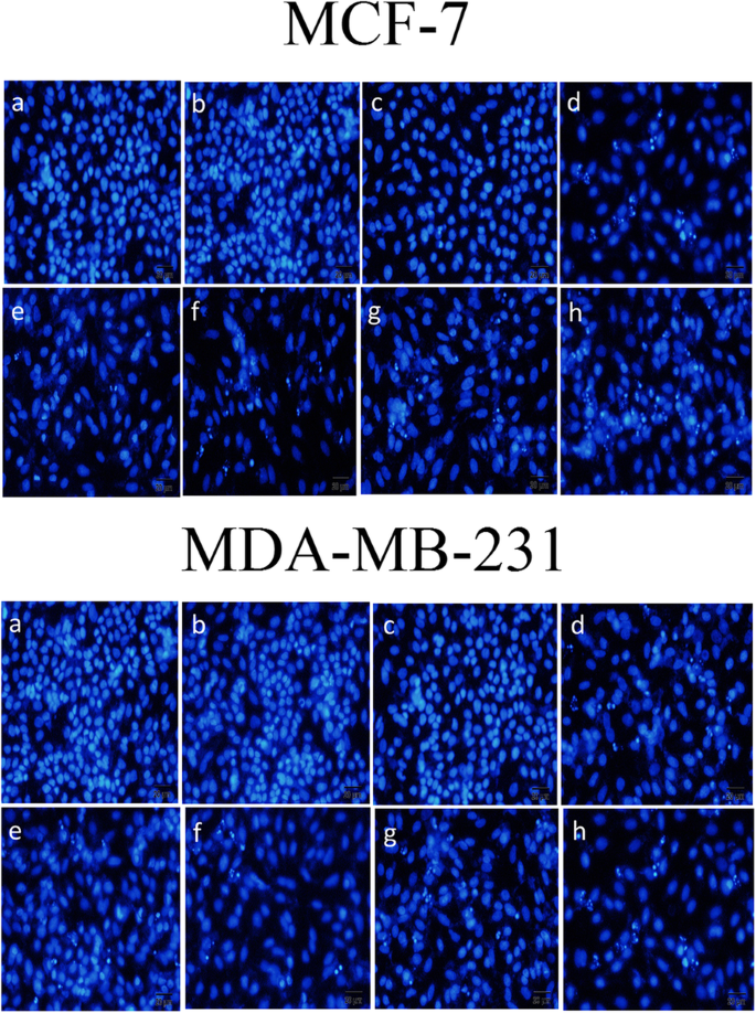 Innovative Methotrexate‑Folate Nanoparticle Therapy Enhances Breast Cancer Treatment with Laser‑Assisted Photothermal Approach