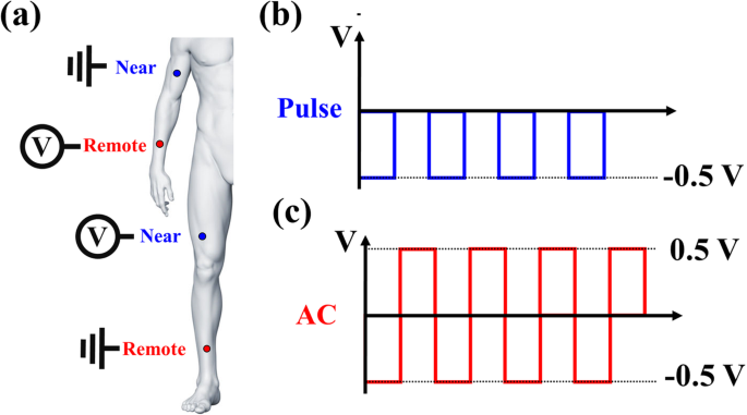 Investigating Meridian Response Currents to Electrical Pulse Acupuncture: A Physics-Based Study