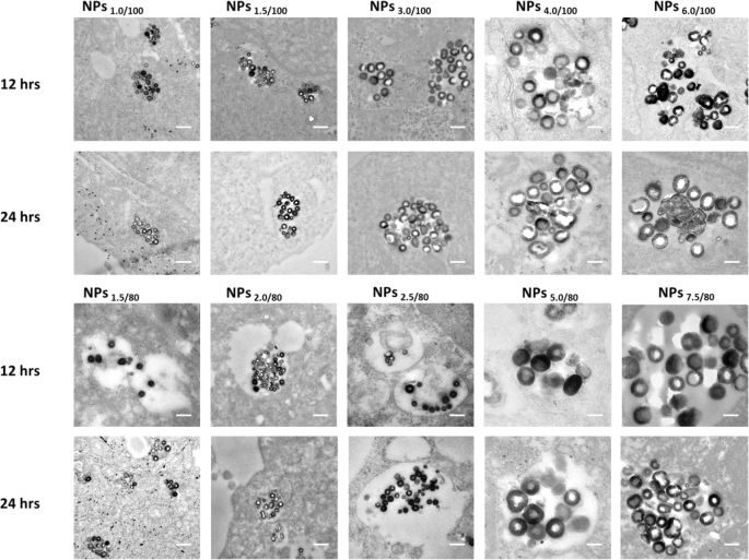Developing a Precise Lysosomal pH Sensor Using Self-Decomposing SiO2 Nanoparticles
