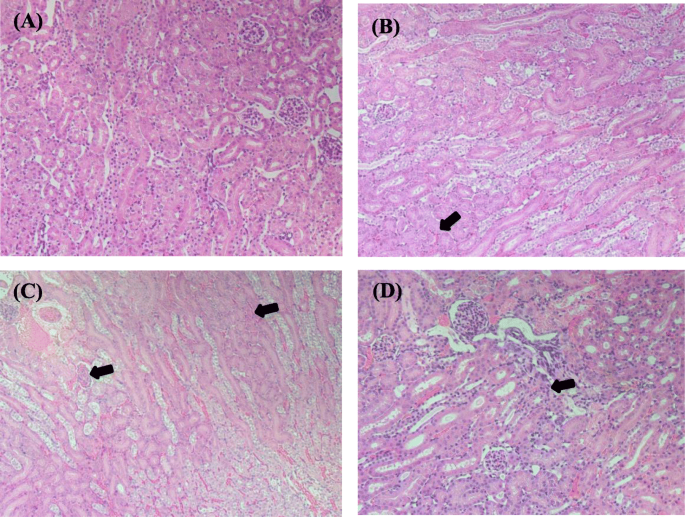 Gold Nanoparticle-Drug Interactions Cause Acute Kidney Damage in Mice: A Size-Dependent Toxicity Study